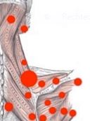 Ausschnitt Triggerpunkte